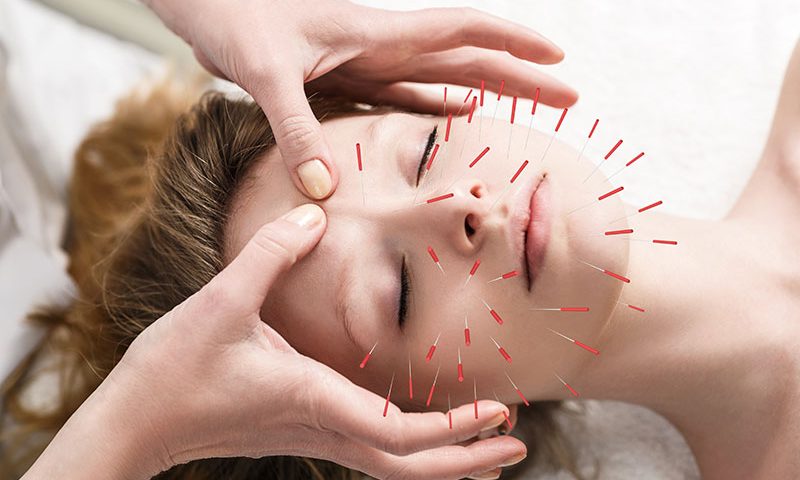 Acupuncture for Anxiety | Ana Heart Blog